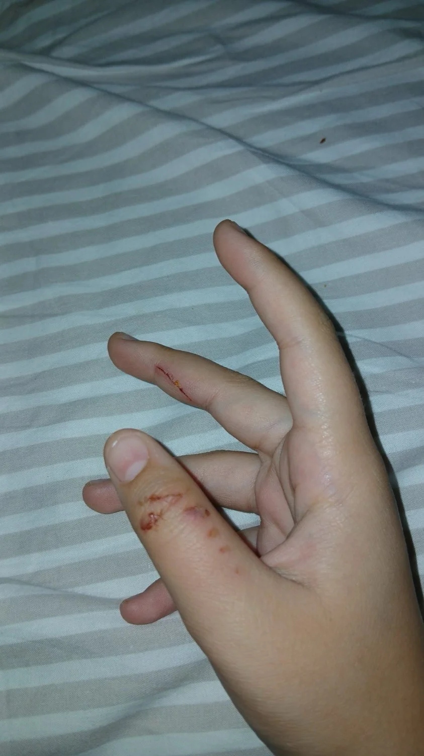 12xroni xeri dagkoma84854