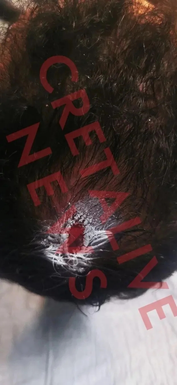 profitis ilias xtypima.jpg