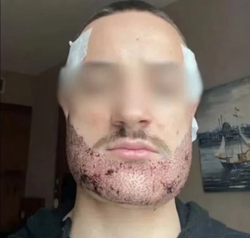 foititis gallia meta epembasi12