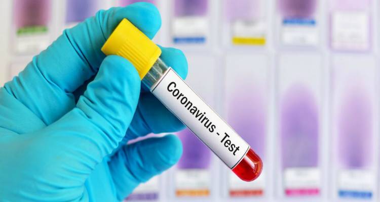 COVID-19: Ολοκληρωμένο σχέδιο για την αύξηση των εργαστηριακών εξετάσεων