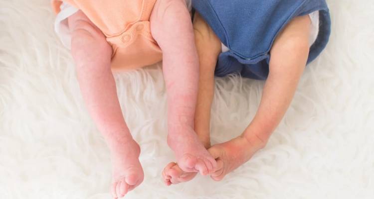 Δίδυμα γεννήθηκαν πρόωρα, με εννέα μέρες διαφορά -Είχαν το μέγεθος παλάμης, η συγκινητική ιστορία τους