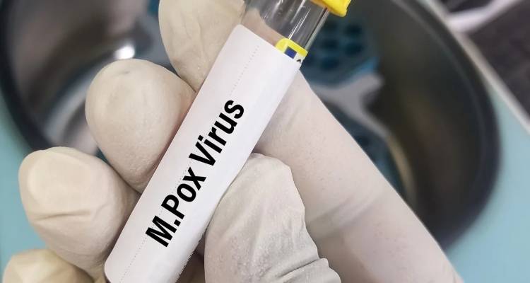 Ευλογιά πιθήκων: Σε συναγερμό η Ευρώπη για το πρώτο κρούσμα στη Σουηδία -Προειδοποιήσεις από τον ΠΟΥ