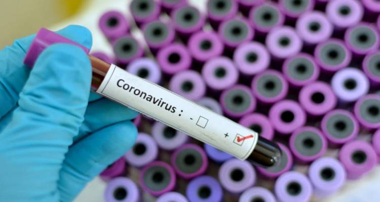 Λήμνος: Θετικός στον Covid-19 άνδρας 72 ετών