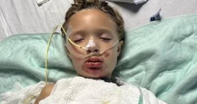 ΗΠΑ: Σε τεχνητό κώμα 7χρονη μετά από challenge στο TikTok