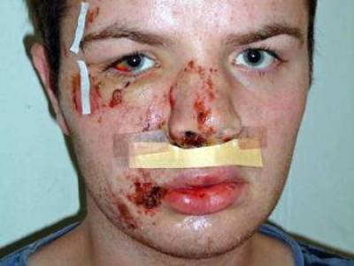 Πρώτα οι μετανάστες, μετά οι γκέι, ύστερα οι ανάπηροι. Όπου να &#039;ναι έρχεται η σειρά σου