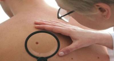 &Delta;&omega;&rho;&epsilon;ά&nu; &epsilon;&xi;έ&tau;&alpha;&sigma;&eta; &mu;&epsilon;&lambda;&alpha;&nu;ώ&mu;&alpha;&tau;&omicron;&sigmaf; &sigma;&tau;&eta; &Lambda;ή&mu;&nu;&omicron;