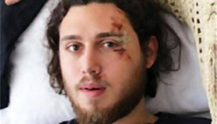 Φοιτητής εισέπραξε γροθιές επειδή δεν πλήρωσε χωρίς απόδειξη