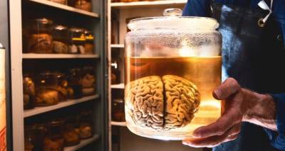 O επιστήμονας που ζήτησε να διατηρηθεί ο εγκέφαλός του μέσα σε μια προθήκη -Γιατί το έκανε