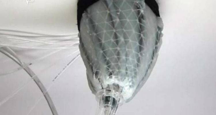 Δημιουργήθηκε το πρώτο μαλακό ρομπότ που «αγκαλιάζει» την καρδιά και τη βοηθά να χτυπά(photo)