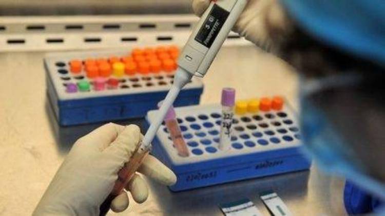Ανακαλύφθηκε γονίδιο που μπορεί να σταματήσει την εξάπλωση του ιού του AIDS