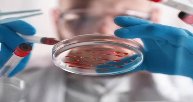 Καρκίνος των ωοθηκών: Ποια επαγγέλματα αυξάνουν τον κίνδυνο