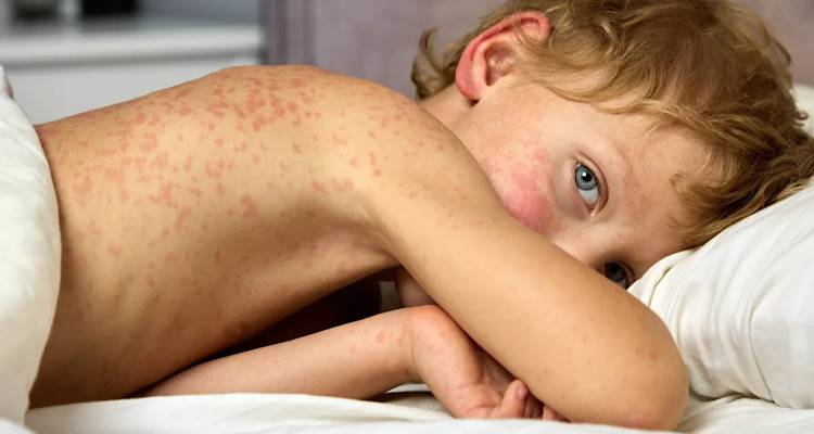 &Iota;&lambda;&alpha;&rho;ά: &Alpha;&nu;&eta;&sigma;&upsilon;&chi;&eta;&tau;&iota;&kappa;ή &alpha;ύ&xi;&eta;&sigma;&eta; &tau;&omega;&nu; &kappa;&rho;&omicron;&upsilon;&sigma;&mu;ά&tau;&omega;&nu; &ndash; &Pi;&epsilon;&rho;&iota;&mu;έ&nu;&omicron;&upsilon;&nu; &nu;&alpha; &laquo;&phi;&omicron;&upsilon;&nu;&tau;ώ&sigma;&epsilon;&iota;&raquo; &tau;&eta;&nu; &alpha;&nu;&omicron;&iota;&xi;&eta;