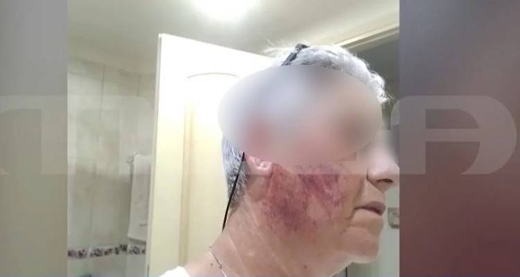 &Chi;&alpha;&lambda;&kappa;ί&delta;&alpha;: &Sigma;&upsilon;&nu;&epsilon;&lambda;ή&phi;&theta;&eta; &nu;&omicron;&sigma;&eta;&lambda;&epsilon;&upsilon;&tau;ή&sigmaf; &gamma;&iota;&alpha; &tau;&omicron;&nu; &xi;&upsilon;&lambda;&omicron;&delta;&alpha;&rho;&mu;ό &tau;&eta;&sigmaf; &sigma;&upsilon;&zeta;ύ&gamma;&omicron;&upsilon; &tau;&omicron;&upsilon; -&laquo;Έ&lambda;&alpha; &nu;&alpha; &delta;&epsilon;&iota;&sigmaf; &pi;ώ&sigmaf; &theta;&alpha; &sigma;&phi;ά&xi;&omega; &tau;&eta; &mu;ά&nu;&alpha; &sigma;&omicron;&upsilon;&raquo;