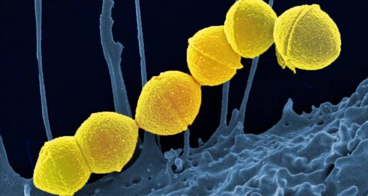 Συναγερμός στην Ιαπωνία: Εξαπλώνεται μυστηριώδης λοίμωξη στρεπτόκοκκου που τρώει τη σάρκα